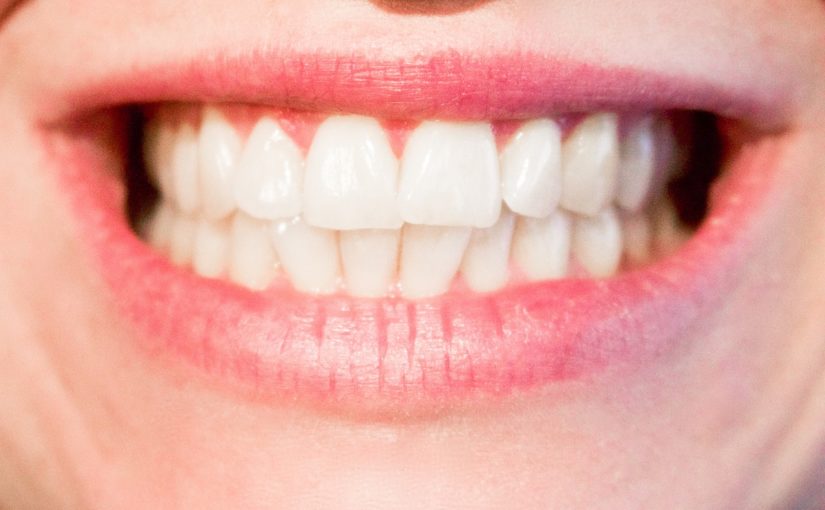 Obecna technika używana w salonach stomatologii estetycznej być może spowodować, że odbierzemy piękny uśmiech.